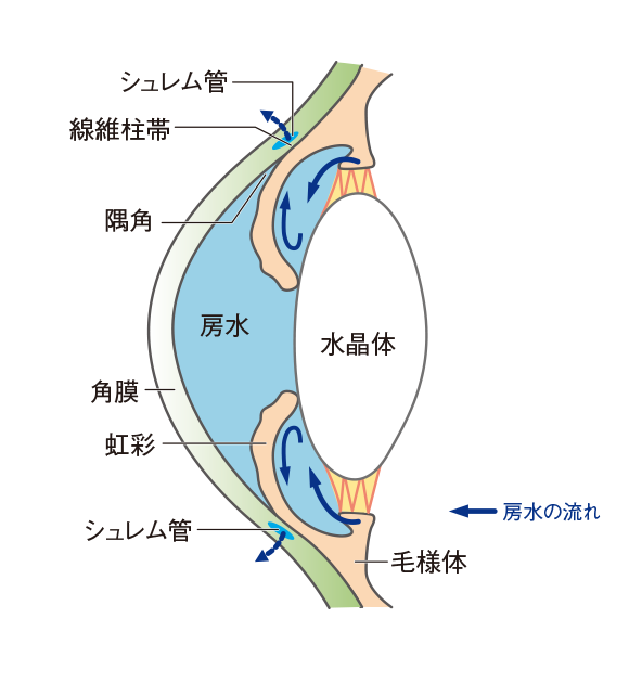 原発閉塞隅角緑内障