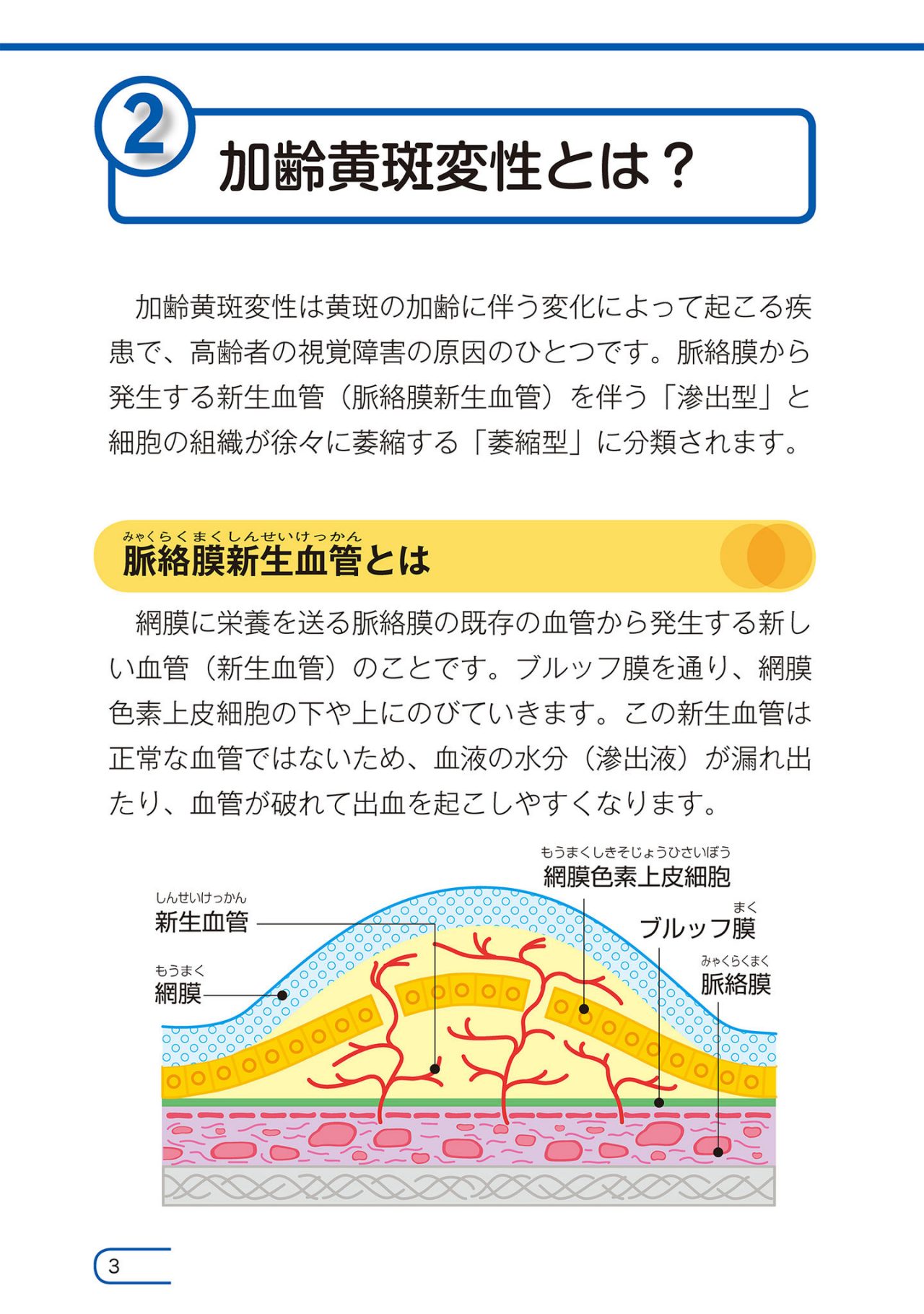 加齢黄斑変性とは？