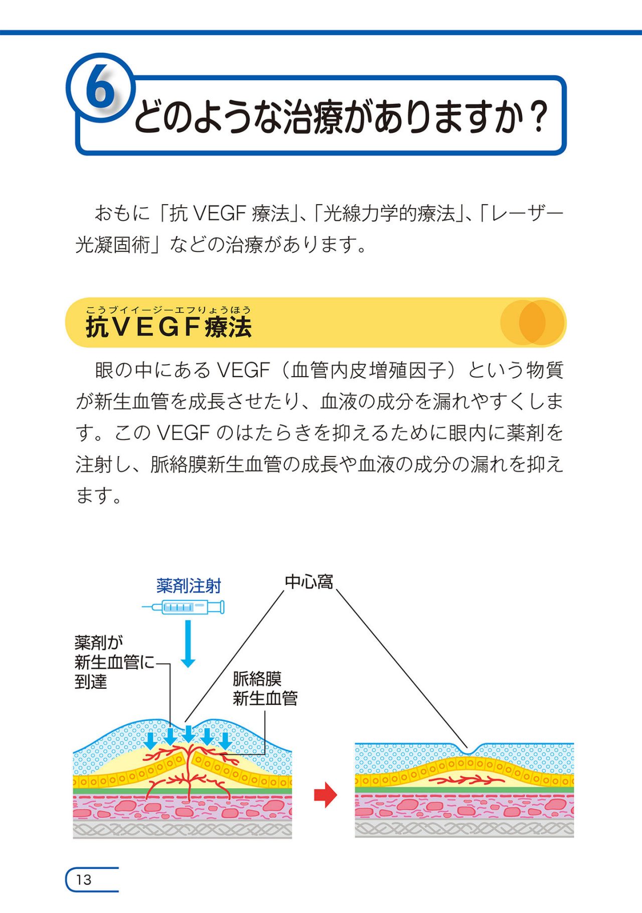 どのような治療がありますか？
