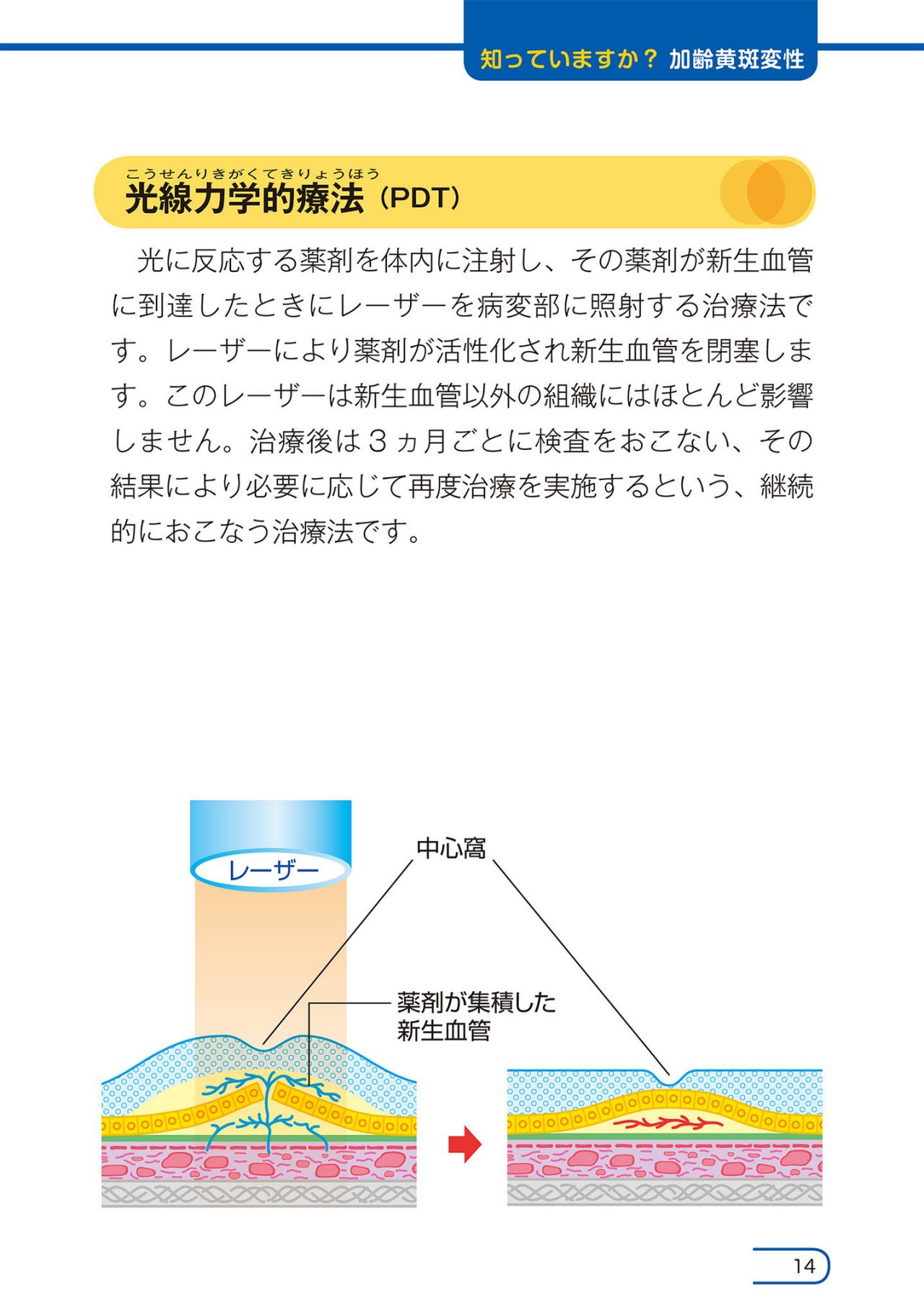 どのような治療がありますか？