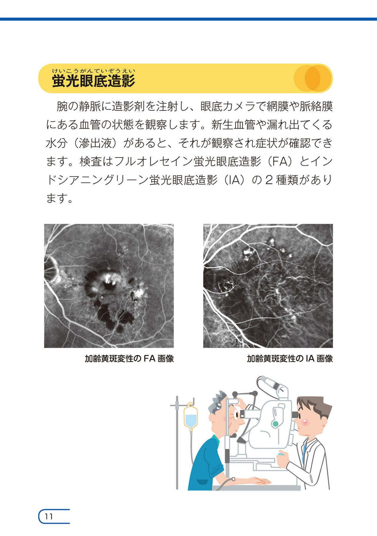 どのような検査がありますか？