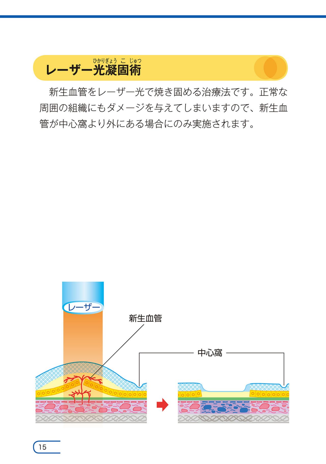 どのような治療がありますか？