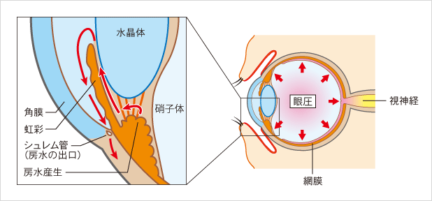 見え方の変化（右眼のみを示す）